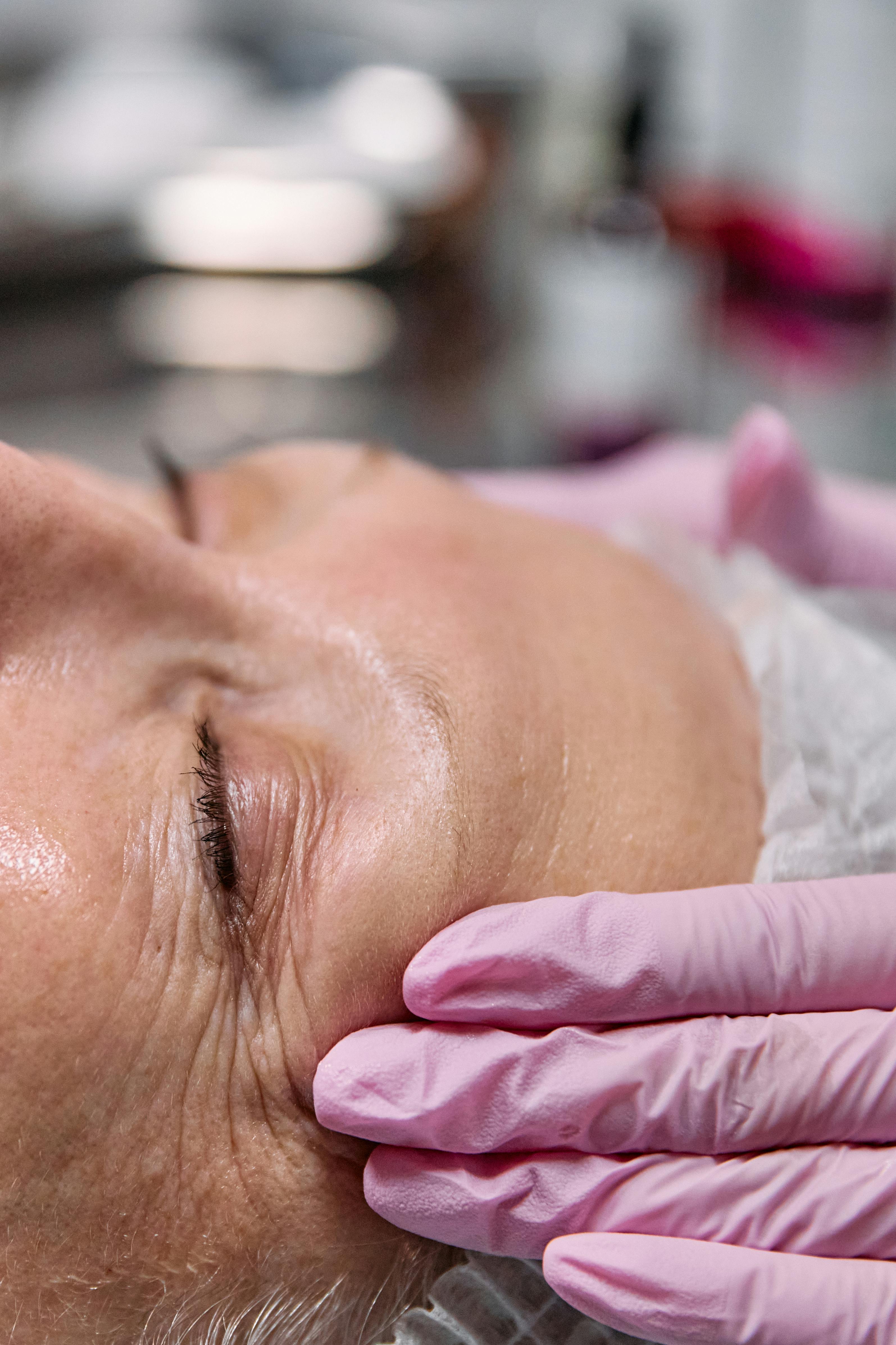 Anti-wrinkle treatment concept